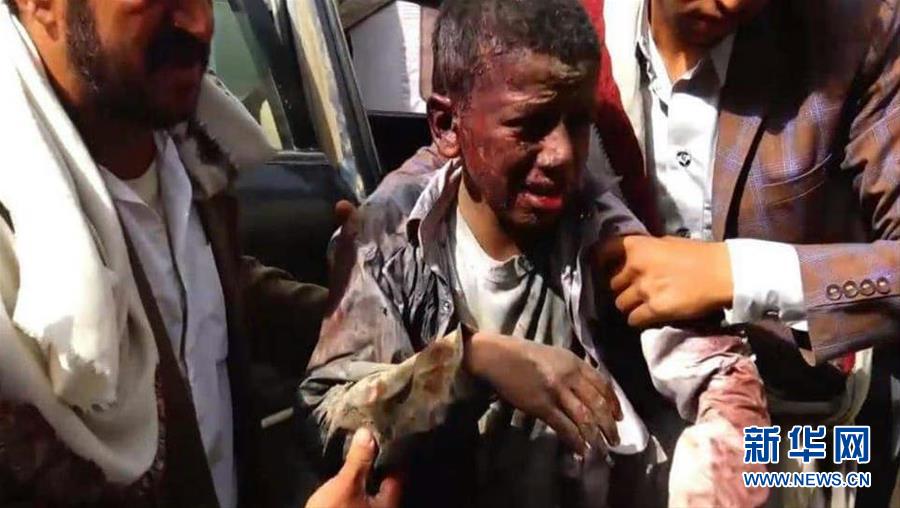 （國際&middot;一周看天下）遭遇空襲的孩子